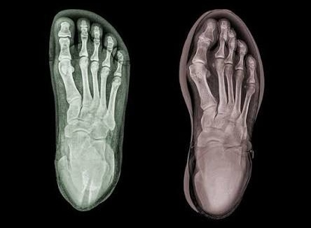 imagesedit255190027152547