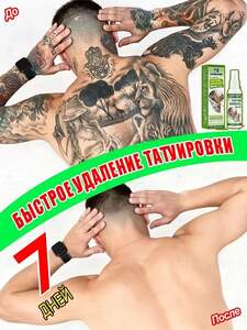 Спрей для удаления татуировок (с картой OZON, из-за рубежа)